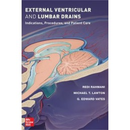 External Ventricular and...