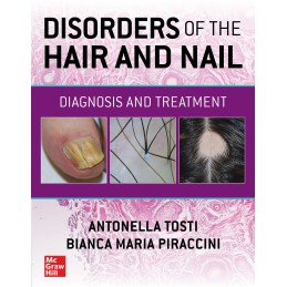 Disorders of the Hair and...
