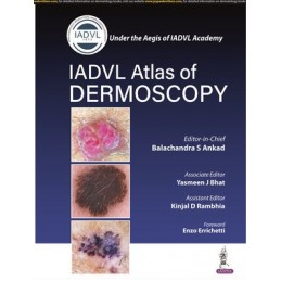Atlas of Dermoscopy