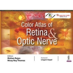 Color Atlas of Retina &...