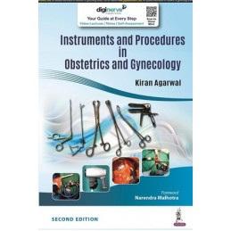 Instruments and Procedures in Obstetrics and Gynecology