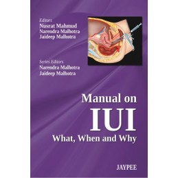 Manual on IUI: What, When...