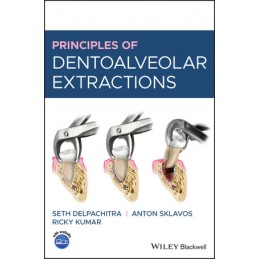 Principles of Dentoalveolar Extractions