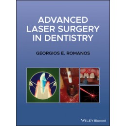 Advanced Laser Surgery in Dentistry