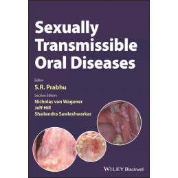 Sexually Transmissible Oral...
