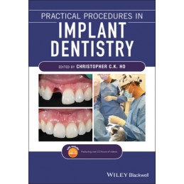 Practical Procedures in Implant Dentistry