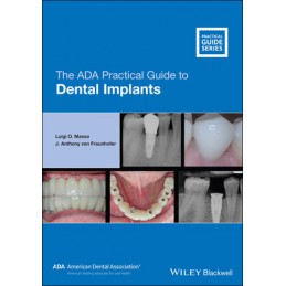 The ADA Practical Guide to Dental Implants