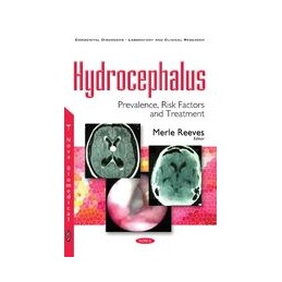 Hydrocephalus: Prevalence,...