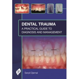 Dental Trauma: A Practical...