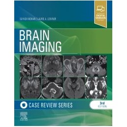 Brain Imaging: Case Review...