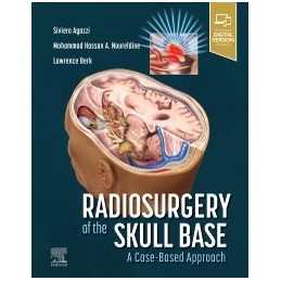 Radiosurgery of the Skull...