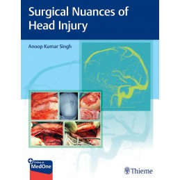 Surgical Nuances of Head...