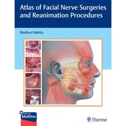 Atlas of Facial Nerve...