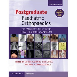 Postgraduate Paediatric Orthopaedics: The Candidate's Guide to the FRCS(Tr&Orth) Examination