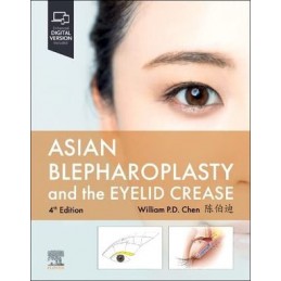 Asian Blepharoplasty and...