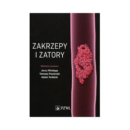 Zakrzepy i zatory