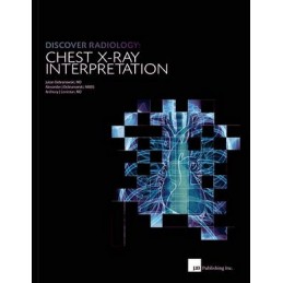 CHEST X-RAY Interpretation....