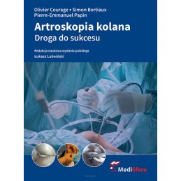 Artroskopia kolana. Droga do sukcesu.