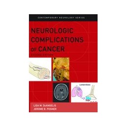 Neurologic Complications of Cancer