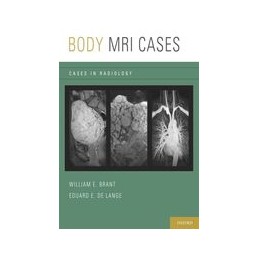 Body MRI Cases