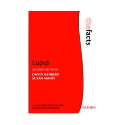 Lupus