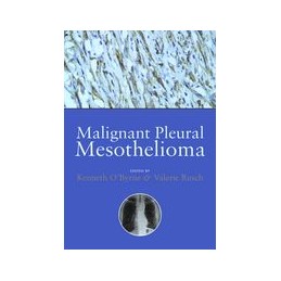 Malignant Pleural Mesothelioma