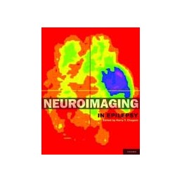 Neuroimaging in Epilepsy