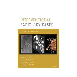 Interventional Radiology Cases