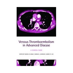 Venous Thromboembolism in...