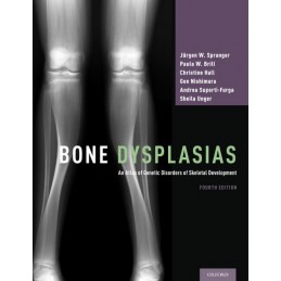 Bone Dysplasias