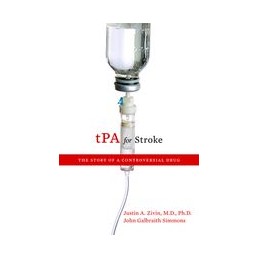 tPA for Stroke