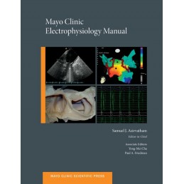 Mayo Clinic Electrophysiology Manual