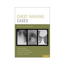 Chest Imaging Cases