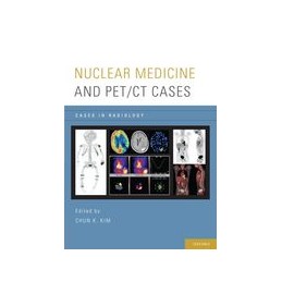 Nuclear Medicine and PET/CT...