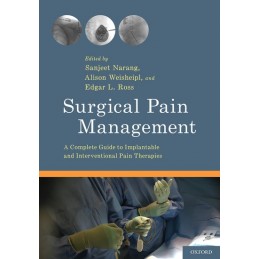 Surgical Pain Management