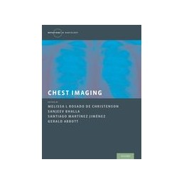 Chest Imaging