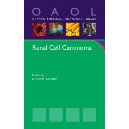 Renal Cell Carcinoma