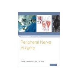 Peripheral Nerve Surgery