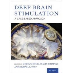 Deep Brain Stimulation