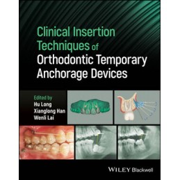 Clinical Insertion Techniques of Orthodontic Temporary Anchorage Devices