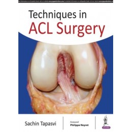 Techniques in ACL Surgery