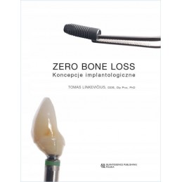 Zero bone loss - koncepcje...