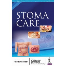 Stoma Care