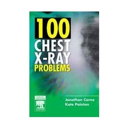 100 Chest X-Ray Problems