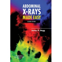 Abdominal X-Rays Made Easy