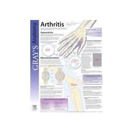 Arthritis