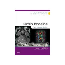 Brain Imaging: Case Review...