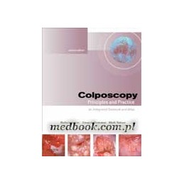 Colposcopy