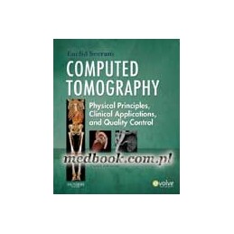 Computed Tomography