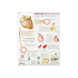 Coronary Artery Disease Chart